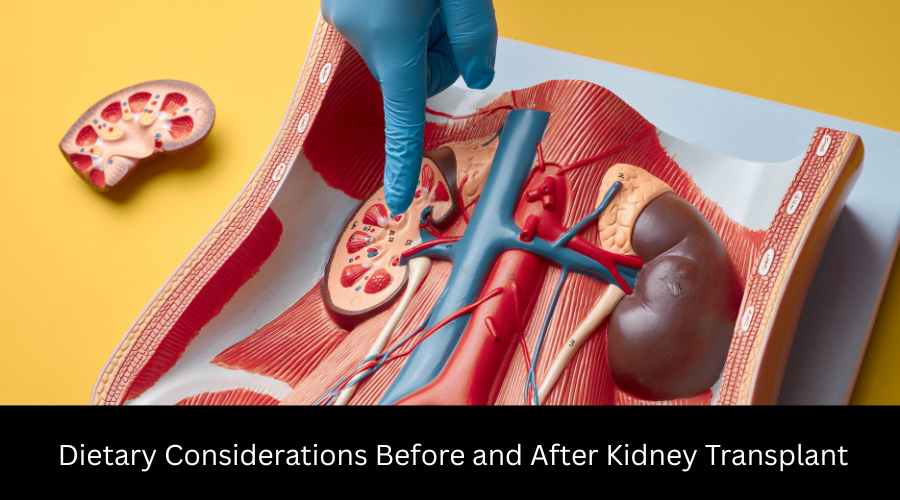 Dietary Considerations Before and After Kidney Transplant